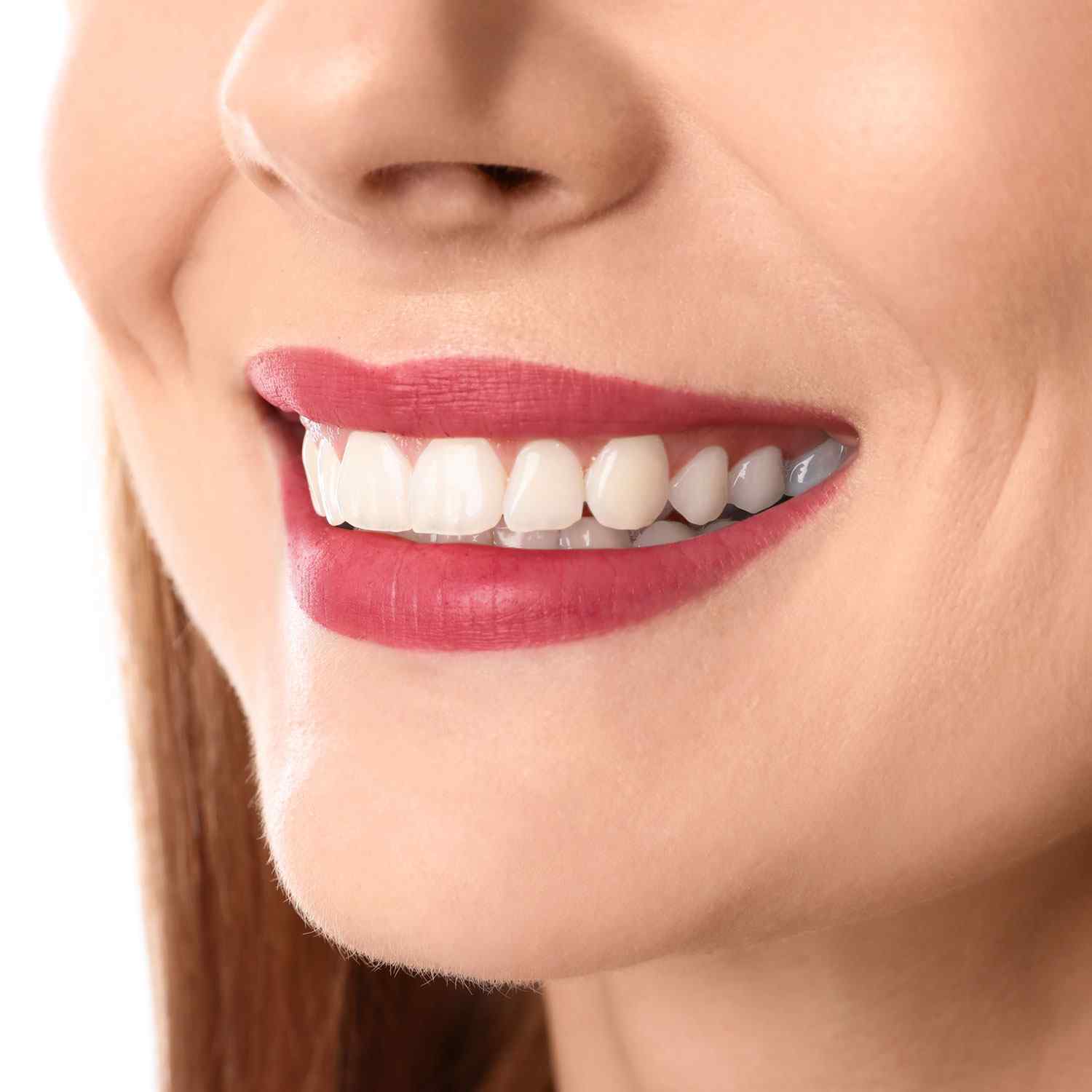 https://dtanilyildiz.com/wp-content/uploads/2020/03/service_whitening.jpg